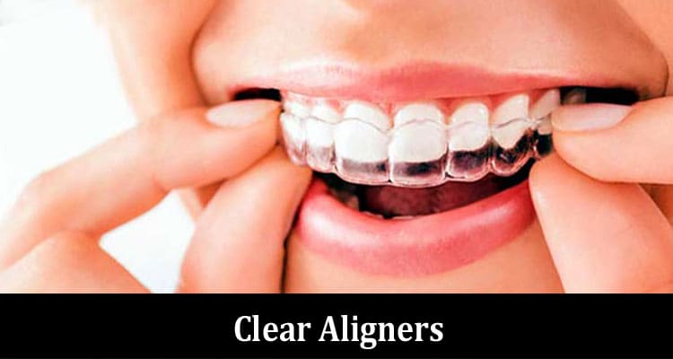 Clear Aligners The Modern Approach to Teeth Straightening